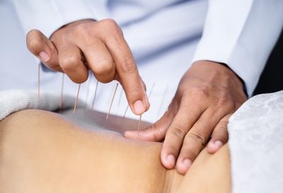 acupuncture-in-vaughan